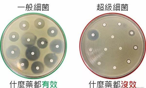 超级细菌用什么药都没效