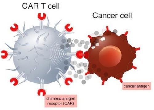 癌癥 抗癌新技術的進展