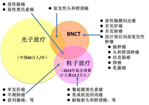 硼中子俘获治疗技术BNCT适应症