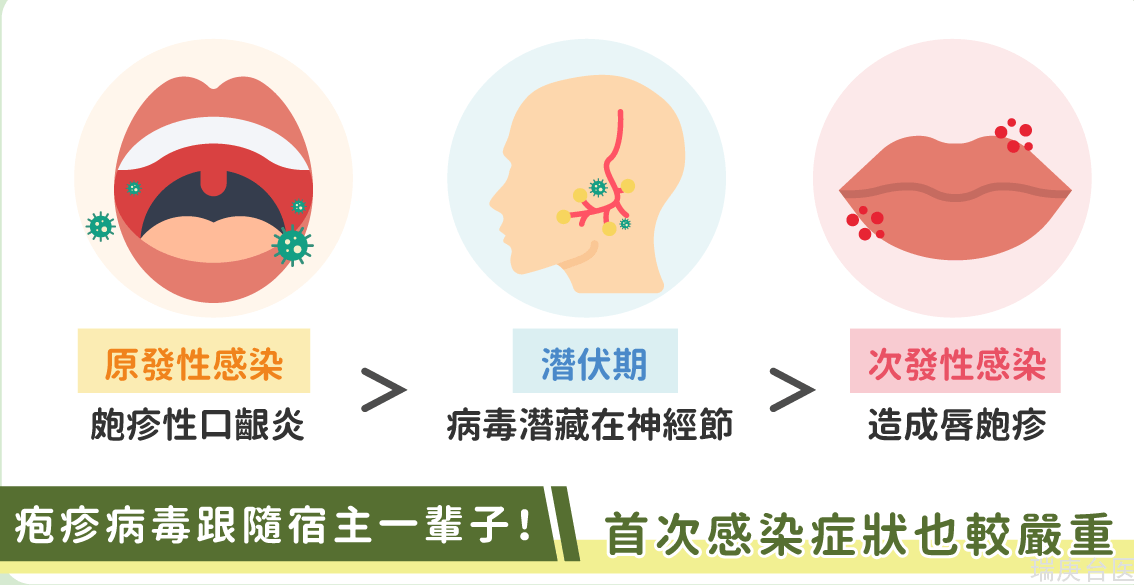 嘴角红肿、水泡怎么办？一表看懂唇疱疹、口角炎的不同！