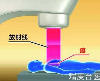 BNCT | 硼中子俘获疗法VS免疫疗法