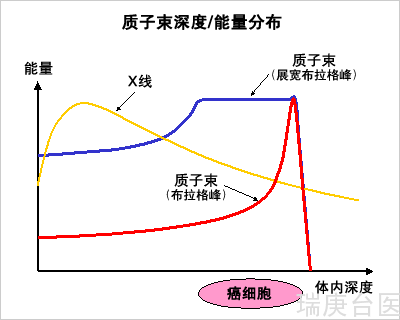 台湾长庚医院 | 乳癌新福音质子放射治疗不伤心