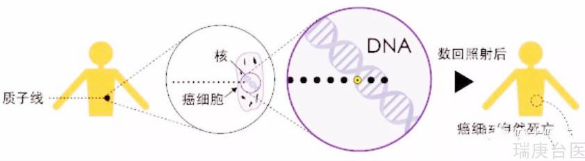 质子治疗 | 质子线可以实现准确治疗，提高癌症治疗效果！