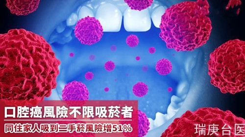 口腔癌风险不限吸烟者 同住家人吸到二手烟风险增51%